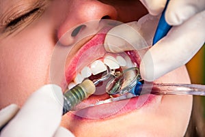 Trattamento sul il dentista 