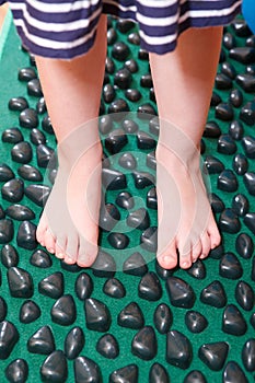 Treatment of flatfoot with massage mat