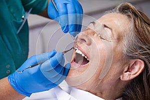 Treatment of gingivitis at the dentist photo