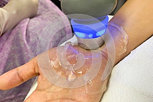 Treatment of hand and wrist injuries and numbness of the hands and nerves Method of treatment with ultrasound machine and gel