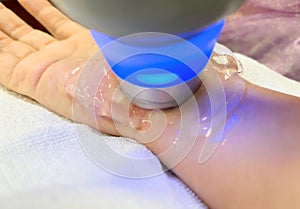 Treatment of hand and wrist injuries and numbness of the hands and nerves Method of treatment with ultrasound machine and gel