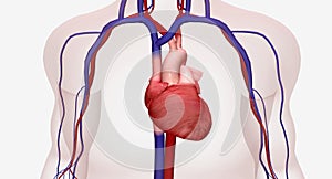 The Treatment for Hypertrophic Cardiomyopathy