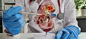 Treatment of kidney diseases and pyelonephritis closeup