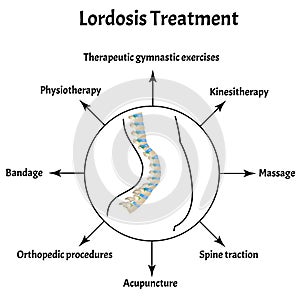 Treatment of lordosis. Spinal curvature, kyphosis, lordosis, scoliosis, arthrosis. Improper posture and stoop