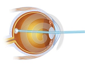 Treatment of macula