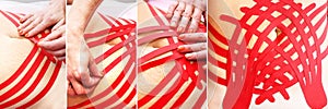 Treatment of skin laxity using kinesiology taping. Women`s belly. Collage with the process of applying.