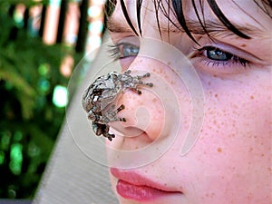 Tree Frog on Boys Face