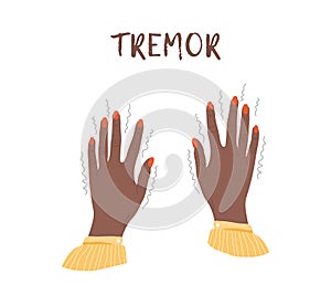 Tremor hands. Parkinson disease. Female arms with nails. Physiological stress symptoms. Vector illustration in flat