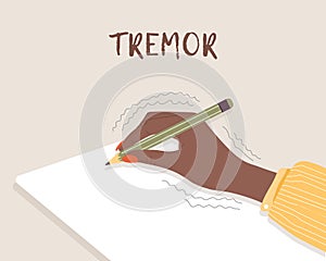 Tremor hands. Primary symptom Parkinson disease. Arms writing with a pen. Physiological stress symptoms. Vector