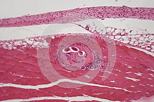 Trichinella spiralis larvae in muscle tissue under the microscope.