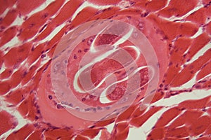 Trichinella spiralis larvae in muscle tissue under the microscope.