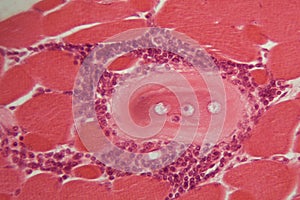 Trichinella spiralis larvae in muscle tissue under the microscope. photo