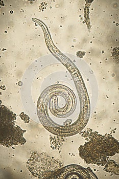 Trichinella spiralis - parasitic nematoda worm microscope