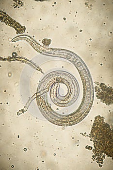 Trichinella spiralis - parasitic nematoda worm microscope photo