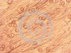 Trichinella spiralis - parasitic worm microscope photo