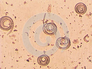 Trichinella spiralis - parasitic worm microscope photo