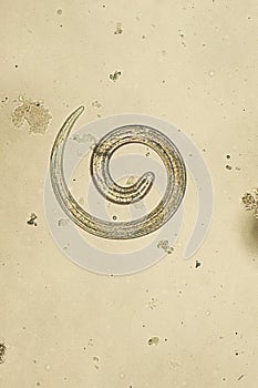 Trichinella spiralis - parasitic nematoda worm microscope photo