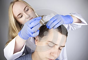 A trichologist doctor drips the serum onto the patient`s hair. Treatment of alopecia. Hair loss, alopecia, pruritus, burning head