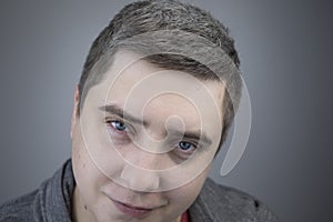 A trichologist examines a young manâ€™s gray hair under a magnifying glass. Earlier bleaching of hair and pigment as a sign of low