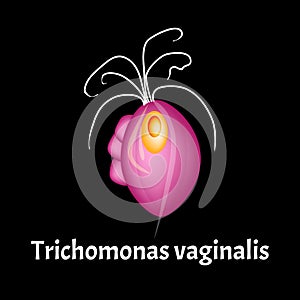 Trichomonas vaginal. Infographics. Vector illustration on isolated background. photo