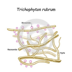 Trichophyton rubrum. Close-up of fungi with fertile hyphae, Macroconidia and Microconidia