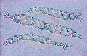 Trichophyton verrucosum fungi, 3D illustration