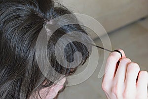 Trichotillomania, human impulse behavioral problem,hair pulling disorder