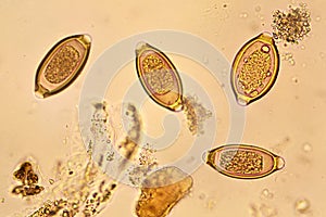 Trichuris trichiura