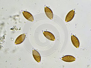 Trichuris trichiura