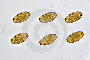 Trichuris trichiura