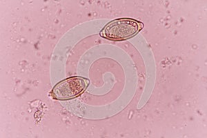 Trichuris trichiura