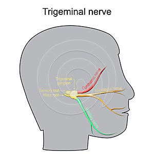 Trigeminal neuralgia. Cranial nerve