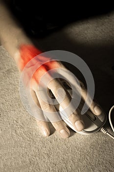 Trigger finger or Carpal Tunnel syndrome,pain from use computer