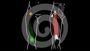 Trigger point rectus femoris muscle. Musculus quadriceps femoris.