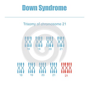 Trisomy of chromosome 21