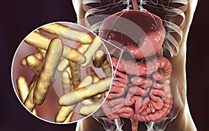 Tropheryma whipplei bacteria in human duodenum, the causative organism of Whipple& x27;s disease photo