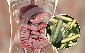 Tropheryma whipplei bacteria in human duodenum, the causative organism of Whipple& x27;s disease photo