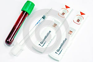 Troponin T test : test for look heart attack of the myocardium f