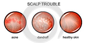 Troubled scalp. dermatology photo