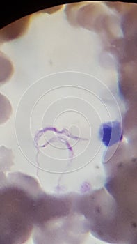 Trypanosoma rhodesiense seen in blood - Sleeping Sickness