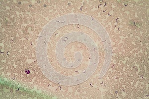 Trypanosomes of Chagas disease parasites