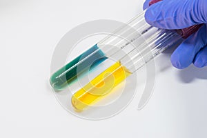 TSI positive and negative for biochem test for bacteria; bioch