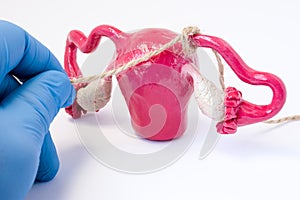 Tubal ligation or surgical procedure tubectomy in operative gynecology concept photo. Doctor binds with rope fallopian tubes model photo