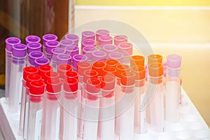 Tube with collection blood samples in laboratory at hospital