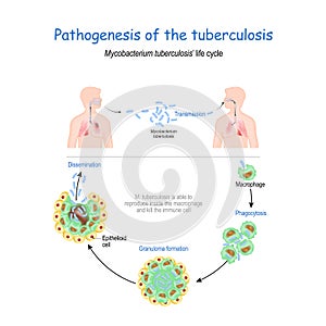 Tuberculosis. Life cycle of Mycobacterium tuberculosis