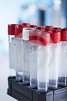 Tubes in the laboratory