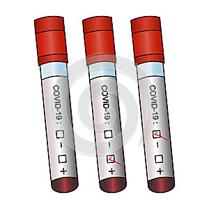 Tubes with patient analyzes. Three results: positive, negative, unprepared. Colored vector set. Isolated colorless background.