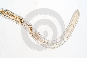 Tubifex worm under microscope view for education