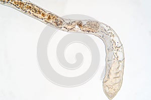 Tubifex worm under microscope view for education