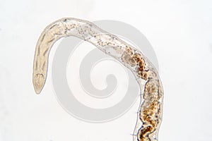 Tubifex worm under microscope view for education